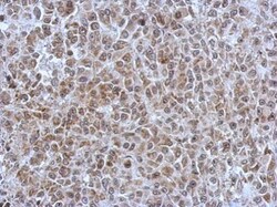 Invitrogen POM121 Polyclonal Antibody 100 &mu;L; Unconjugated:Antibodies,