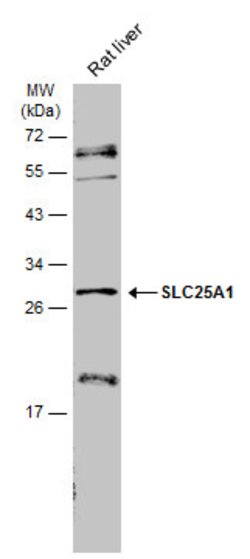 Invitrogen SLC25A1 Polyclonal Antibody 100 &mu;L; Unconjugated:Antibodies,