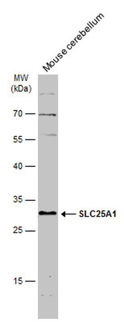 Invitrogen SLC25A1 Polyclonal Antibody 100 &mu;L; Unconjugated:Antibodies,