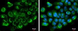 Invitrogen Albumin Polyclonal Antibody 100 &mu;L; Unconjugated:Antibodies,