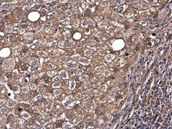 Invitrogen Albumin Polyclonal Antibody 100 &mu;L; Unconjugated:Antibodies,