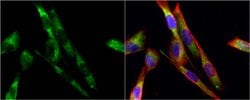 Invitrogen&trade;&nbsp;Tyrosine Hydroxylase Polyclonal Antibody