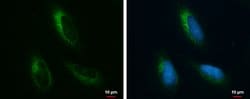 Invitrogen GRP78 Polyclonal Antibody 100 &mu;L; Unconjugated:Antibodies,