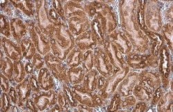 Invitrogen GRP78 Polyclonal Antibody 100 &mu;L; Unconjugated:Antibodies,