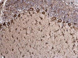 Invitrogen GRP78 Polyclonal Antibody 100 &mu;L; Unconjugated:Antibodies,
