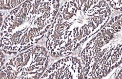 Invitrogen GRP78 Polyclonal Antibody 100 &mu;L; Unconjugated:Antibodies,