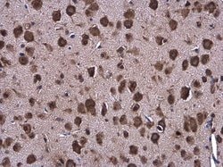 Invitrogen GRP78 Polyclonal Antibody 100 &mu;L; Unconjugated:Antibodies,