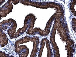 Invitrogen GRP78 Polyclonal Antibody 100 &mu;L; Unconjugated:Antibodies,