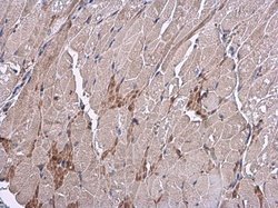 Invitrogen VEGF Polyclonal Antibody 100 &mu;L; Unconjugated:Antibodies,