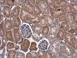 Invitrogen VEGF Polyclonal Antibody 100 &mu;L; Unconjugated:Antibodies,