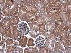 Invitrogen VEGF Polyclonal Antibody 100 &mu;L; Unconjugated:Antibodies,