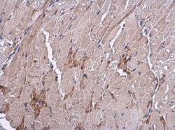 Invitrogen VEGF Polyclonal Antibody 100 &mu;L; Unconjugated:Antibodies,