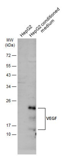 Invitrogen VEGF Polyclonal Antibody 100 &mu;L; Unconjugated:Antibodies,