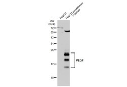 Invitrogen VEGF Polyclonal Antibody 100 &mu;L; Unconjugated:Antibodies,