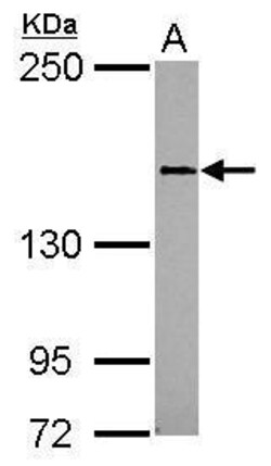 Invitrogen CD100 Polyclonal Antibody 100 &mu;L; Unconjugated:Antibodies,