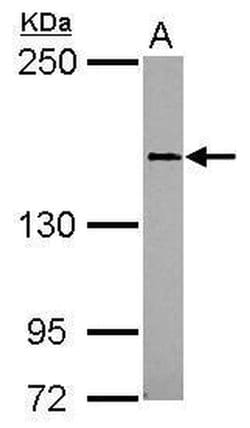 Invitrogen CD100 Polyclonal Antibody 100 &mu;L; Unconjugated:Antibodies,