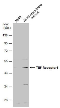 TNFR1 Polyclonal Antibody:Antibodies, Polyclonal