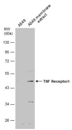 TNFR1 Polyclonal Antibody:Antibodies, Polyclonal