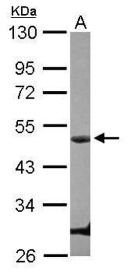 Invitrogen Cyclin E Polyclonal Antibody 100 &mu;L; Unconjugated:Antibodies,
