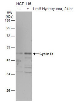 Invitrogen Cyclin E Polyclonal Antibody 100 &mu;L; Unconjugated:Antibodies,