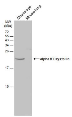 Invitrogen CRYAB Polyclonal Antibody 100 &mu;L | Buy Online | Invitrogen&trade; | Fisher Scientific