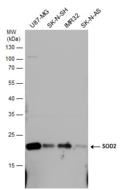 Invitrogen SOD2 Polyclonal Antibody 100 &mu;L; Unconjugated:Antibodies,