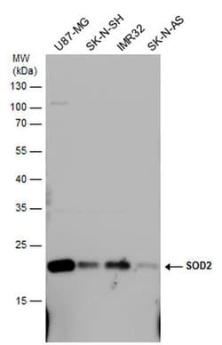 Invitrogen SOD2 Polyclonal Antibody 100 &mu;L; Unconjugated:Antibodies,