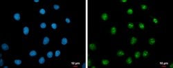 Invitrogen c-Myc Polyclonal Antibody 100 &mu;L; Unconjugated:Antibodies,