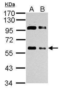 Invitrogen c-Myc Polyclonal Antibody 100 &mu;L; Unconjugated:Antibodies,