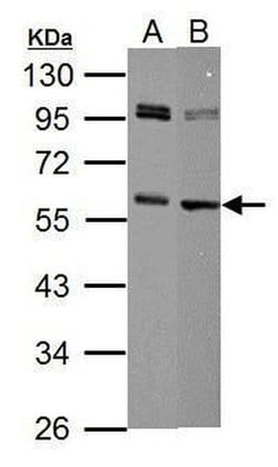 Invitrogen c-Myc Polyclonal Antibody 100 &mu;L; Unconjugated:Antibodies,