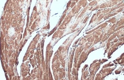 Invitrogen Desmin Polyclonal Antibody 100 &mu;L; Unconjugated:Antibodies,
