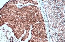 Invitrogen Desmin Polyclonal Antibody 100 &mu;L; Unconjugated:Antibodies,