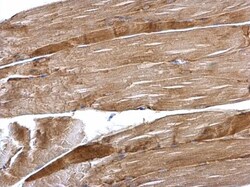 Invitrogen Desmin Polyclonal Antibody 100 &mu;L; Unconjugated:Antibodies,