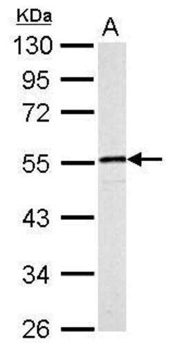 Invitrogen Desmin Polyclonal Antibody 100 &mu;L; Unconjugated:Antibodies,