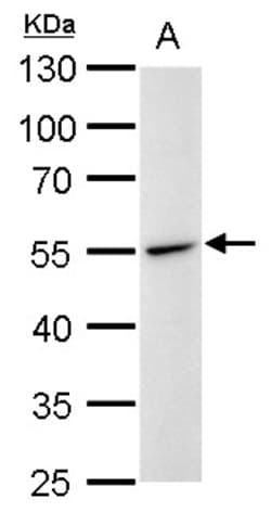 Invitrogen Desmin Polyclonal Antibody 100 &mu;L; Unconjugated:Antibodies,