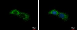 Invitrogen ALDH7A1 Polyclonal Antibody 100 &mu;L; Unconjugated:Antibodies,