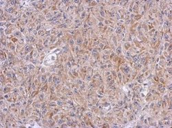 Invitrogen ALDH7A1 Polyclonal Antibody 100 &mu;L; Unconjugated:Antibodies,