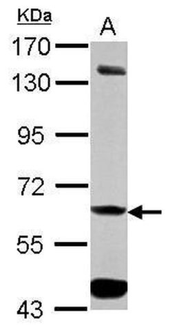 Invitrogen ALDH7A1 Polyclonal Antibody 100 &mu;L; Unconjugated:Antibodies,