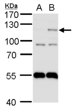 Invitrogen HIF-2 alpha Polyclonal Antibody 100 &mu;L | Buy Online | Invitrogen&trade; | Fisher Scientific