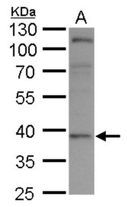 XRCC3 Polyclonal Antibody, Invitrogen 100 &mu;L; Unconjugated:Antibodies,