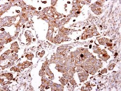 Invitrogen GLB1 Polyclonal Antibody 100 &mu;L; Unconjugated:Antibodies,