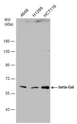 Invitrogen GLB1 Polyclonal Antibody 100 &mu;L; Unconjugated:Antibodies,