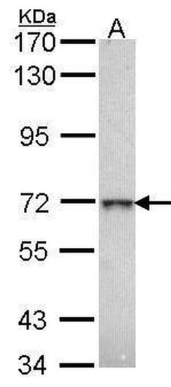 Invitrogen GLB1 Polyclonal Antibody 100 &mu;L; Unconjugated:Antibodies,