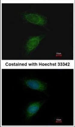 Invitrogen MMP2 Polyclonal Antibody 100 &mu;L; Unconjugated:Antibodies,