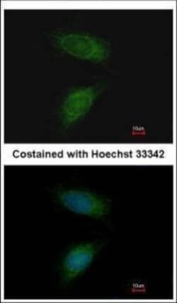 Invitrogen MMP2 Polyclonal Antibody 100 &mu;L; Unconjugated:Antibodies,