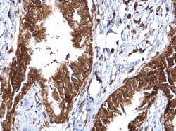 Invitrogen MMP2 Polyclonal Antibody 100 &mu;L; Unconjugated:Antibodies,