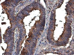 Invitrogen MMP2 Polyclonal Antibody 100 &mu;L; Unconjugated:Antibodies,
