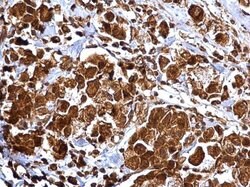Invitrogen MMP2 Polyclonal Antibody 100 &mu;L; Unconjugated:Antibodies,