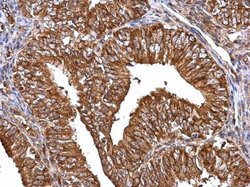 Invitrogen MMP2 Polyclonal Antibody 100 &mu;L; Unconjugated:Antibodies,