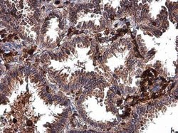 Invitrogen MMP2 Polyclonal Antibody 100 &mu;L; Unconjugated:Antibodies,